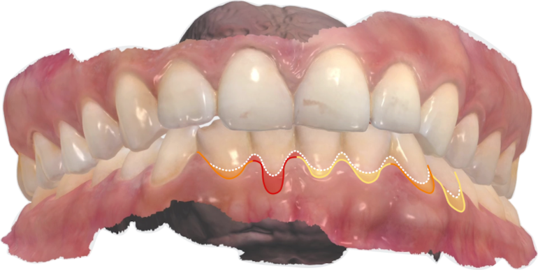 Transparenz, die Sie verstehen